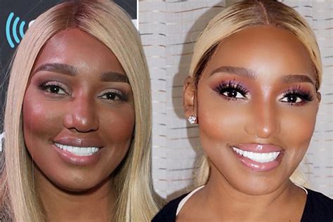 nene leaks before surgery|NeNe Leakes Plastic Surgery: Before, After Photos